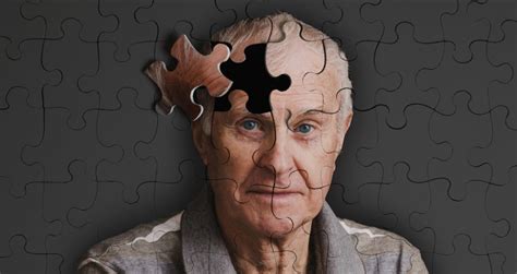 Boala Alzheimer Familiala Fad4 Psen2