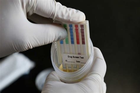 Test Antidoping Ce Inseamna